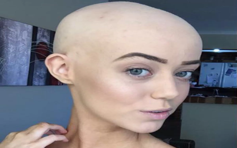 Tennis Star Humiliates Bald Girl, What Happened Next Shocked Everyone