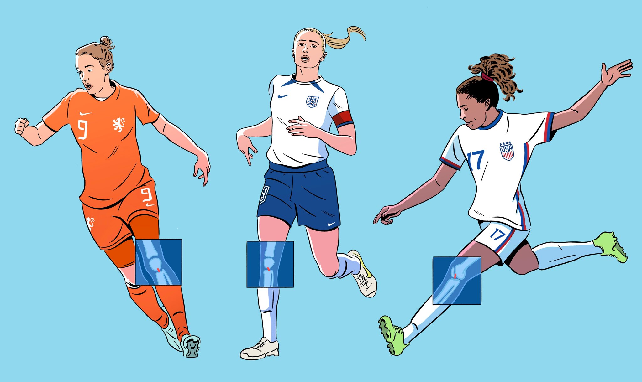 ACL Rates in Womens Sports How Soccer Became a Hotspot Sport